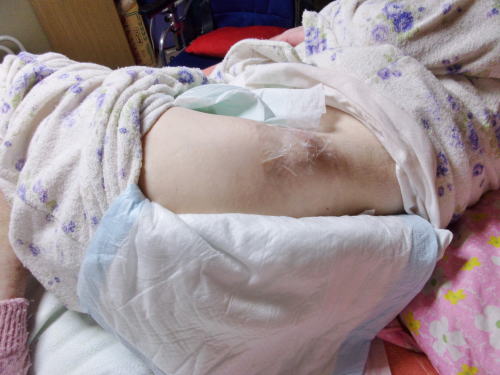 ���b�v�Ö@